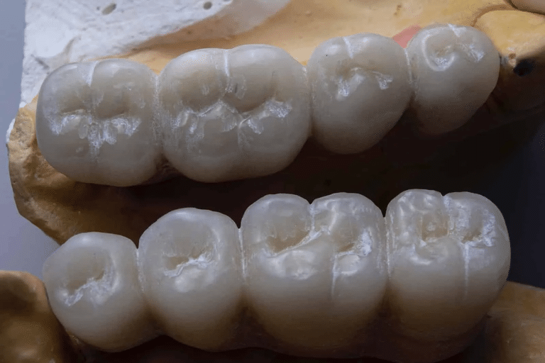 Why Does My Breath Smell Bad After Wisdom Teeth Removal