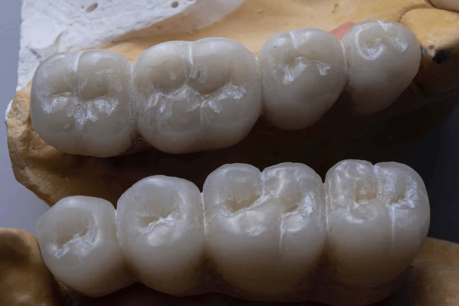 Why Does My Breath Smell Bad After Wisdom Teeth Removal